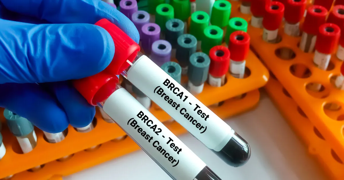 New international guidelines boost accuracy for cancer genetic testing