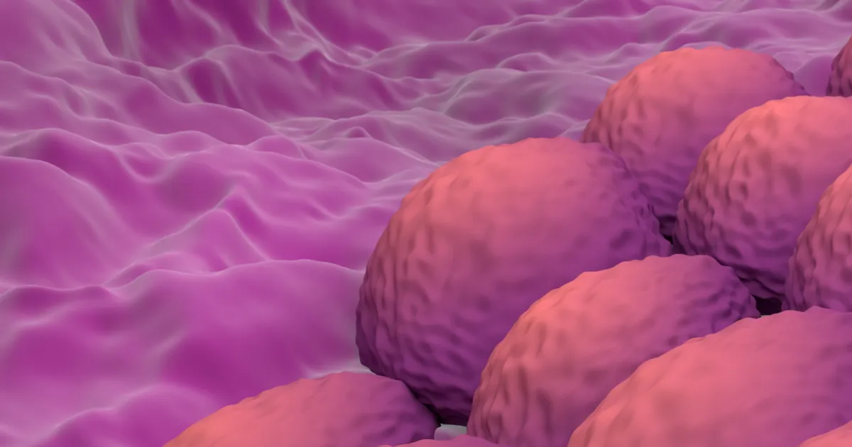 Research sheds light on key drivers of endometrial cancer