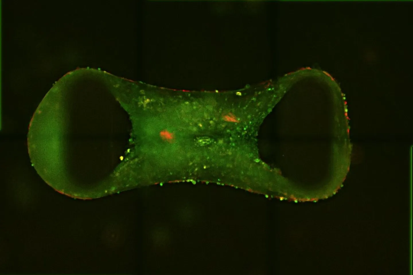 Lab-grown ‘tiny hearts’ bring hope for children and adults 
with genetic heart disease
