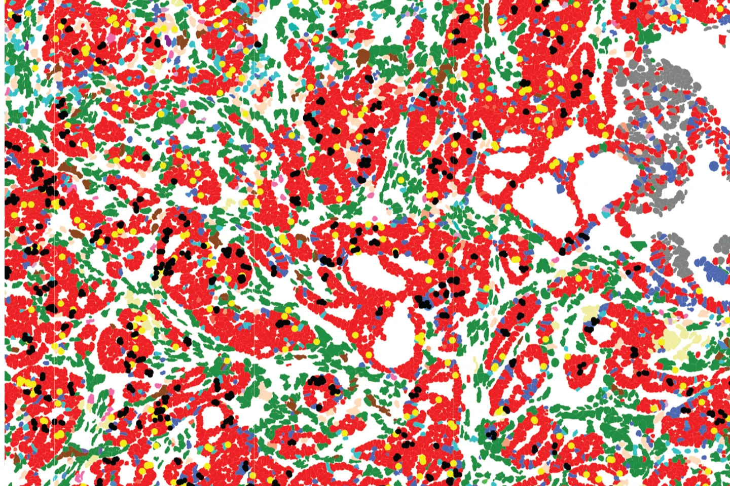 Powerful new tool reveals potential ‘goldmine’ of cancer targets hidden in ‘junk DNA’