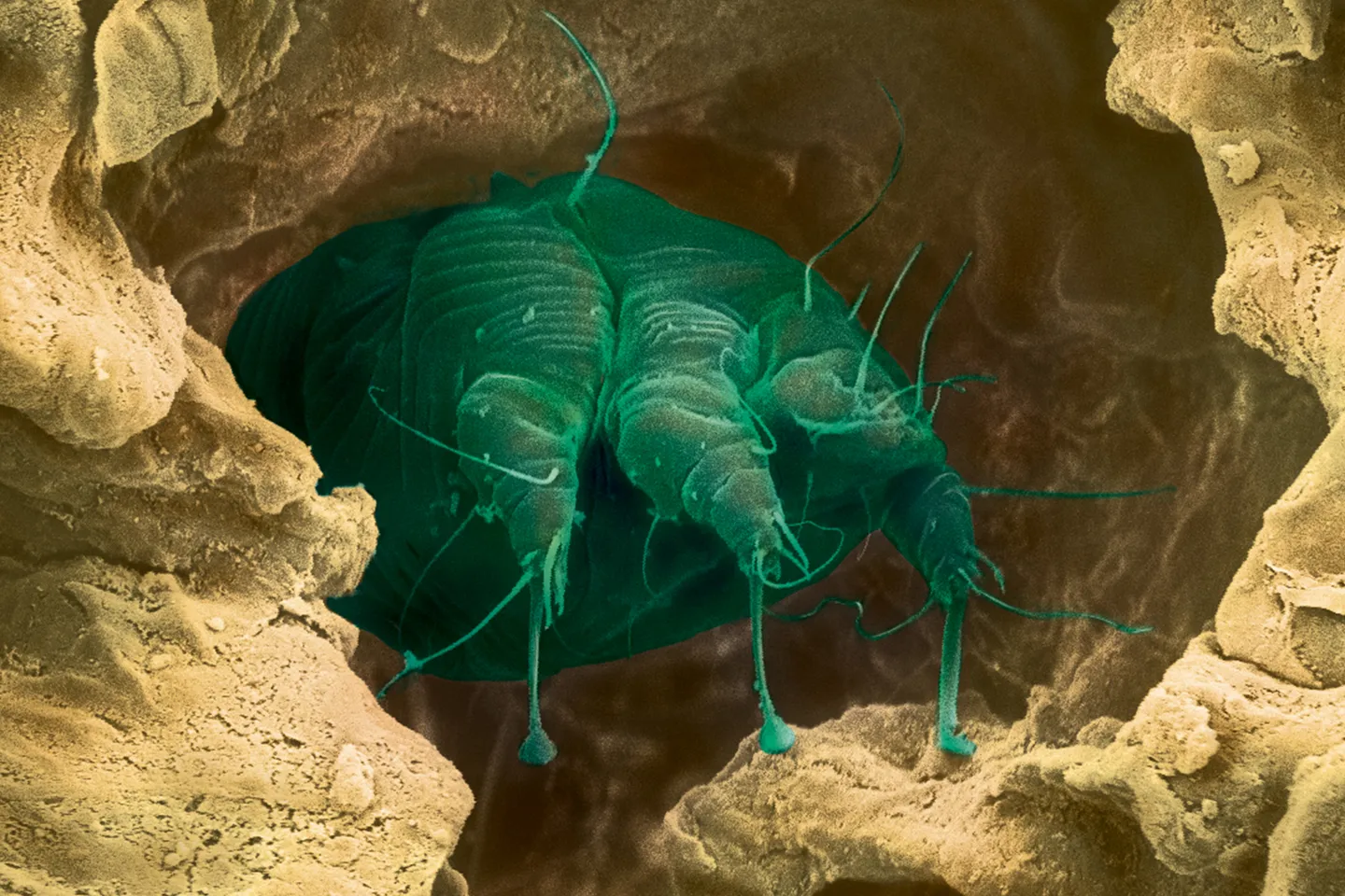 A scabies mite