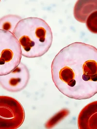 Malaria infection in blood cells