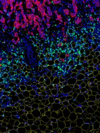 The Cancer Metabolism Group - web graphic