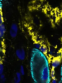 Cardiac Bioengineering QIMR raphic