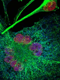 The Oncogenomics laboratory  - melanoma graphic