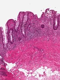Gut Health Lab (gut tissue)
