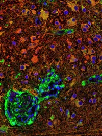 Sid Faithfull Brain Cancer Laboratory - web graphic