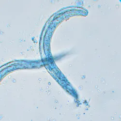 The Molecular Parasitology Laboratory - strongyloides