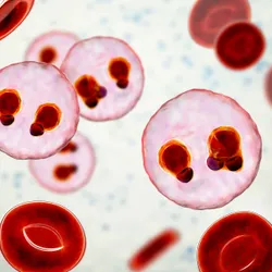 Malaria infection in blood cells