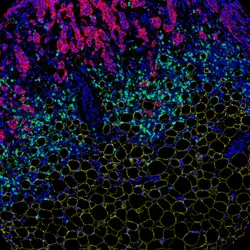 The Cancer Metabolism Group - web graphic