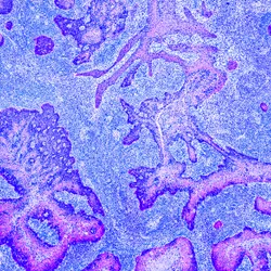 Cancer Control - web graphic