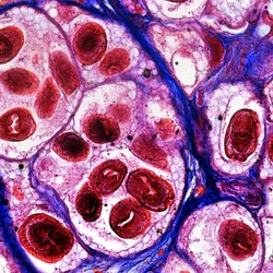Echinococcosis - web graphic