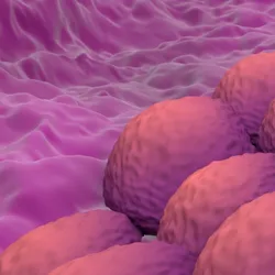 Endometrial cancer - web graphic
