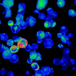 Epstein-Barr virus ells