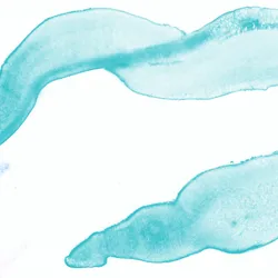 Intestinal worms - web graphic