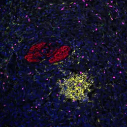 The Post Treatment Cancer Immunobiology Laboratory - web graphic