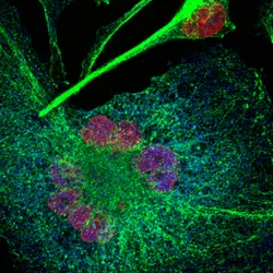 The Oncogenomics laboratory  - melanoma graphic