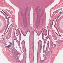QIMR Berghofer Histology Facility - tissue sample