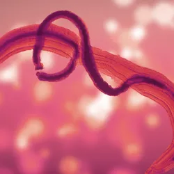 Schistosomiasis - graphic