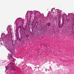 Gut Health Lab (gut tissue)