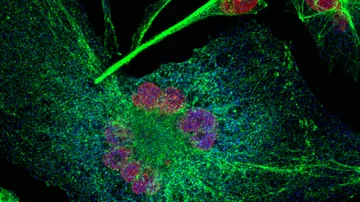 The Oncogenomics laboratory  - melanoma graphic