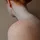 QIMRB-skin-cancer