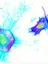 Breast cancer cells