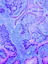 Cancer Control - web graphic