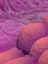 Endometrial cancer - web graphic