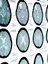 Epilepsy - web graphic