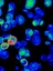 Epstein-Barr virus ells