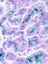 Haemochromatosis under a microscope