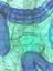 Inflammatory Bowel Disease