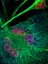 The Oncogenomics laboratory  - melanoma graphic