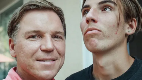 Breakthrough in acne research