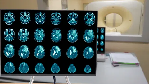 Cyteph completes recruitment for Phase I clinical trial of CYT-101 in patients with recurrent glioblastoma multiforme