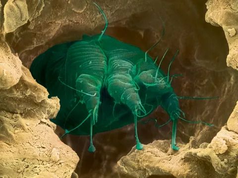 A scabies mite