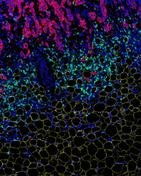 The Cancer Metabolism Group - web graphic