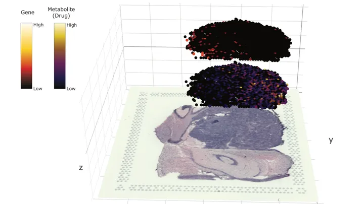 Mapping the transcriptome, metabolome and drug in brain cancer