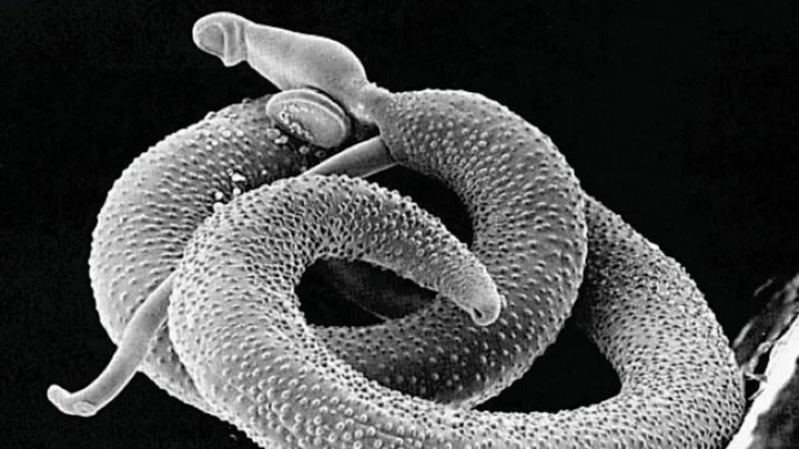 s.-mansoni