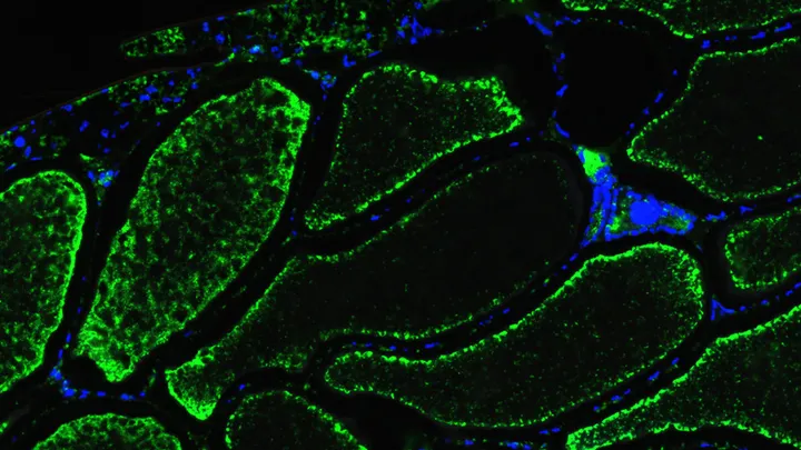 Wolbachia and Dengue stained ovaries