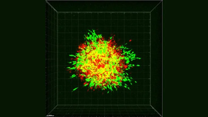 Cancer cells