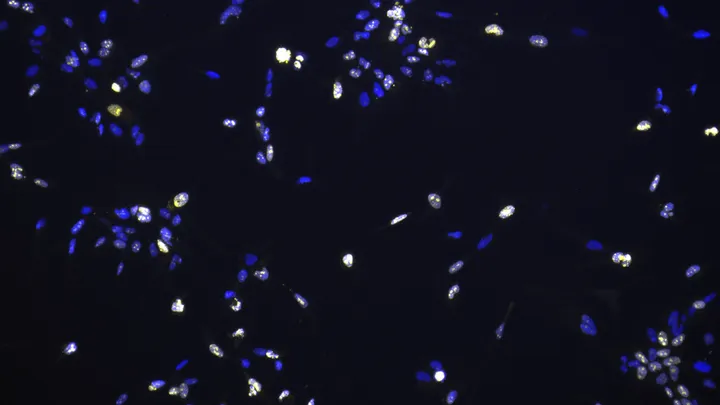 Cancer cells