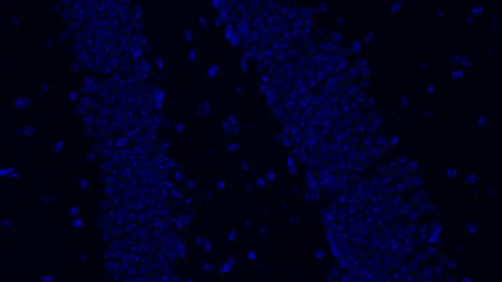 A section of brain tissue