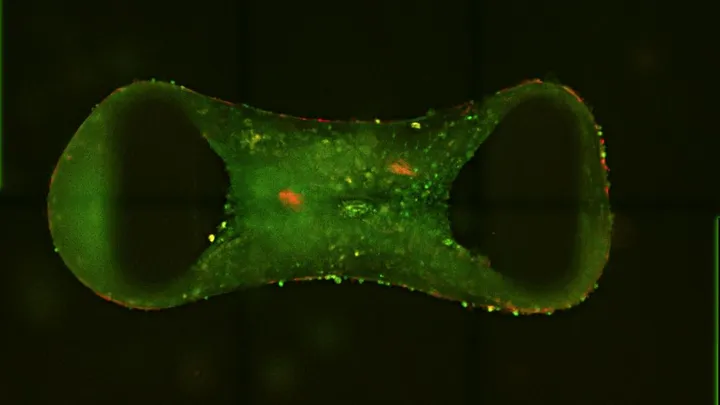 Lab-grown ‘tiny hearts’ bring hope for children and adults 
with genetic heart disease
