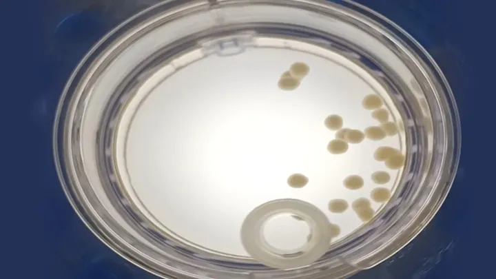 The Cellular and Molecular Neurodegeneration Laboratory project 7