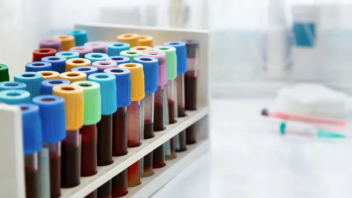 Blood samples