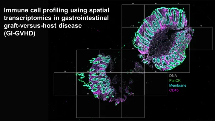 Immune cell profiling using spatial transcriptomics