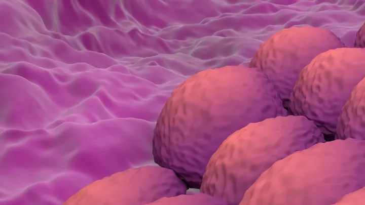 Endometrial cancer - web graphic