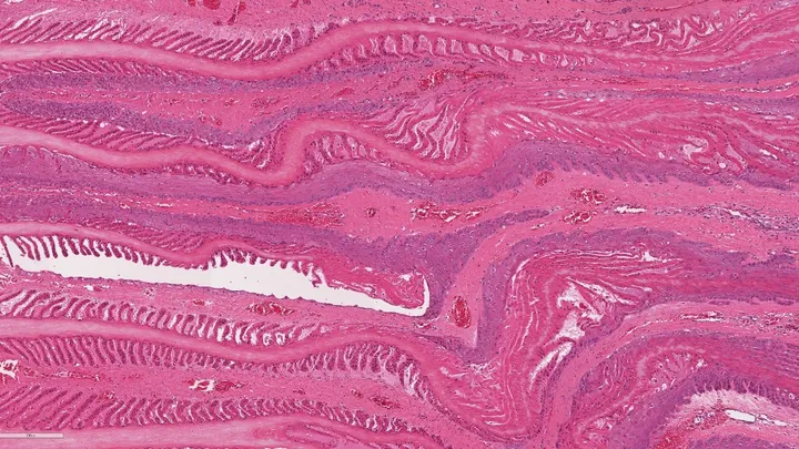 Epithelial cells